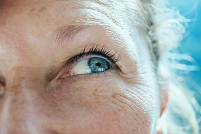 The image shows a close-up of an elderly person s face with a noticeable blue eye, and the individual appears to be looking directly at the camera.